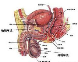 精索静脉曲张