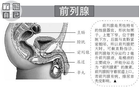 前列腺增生